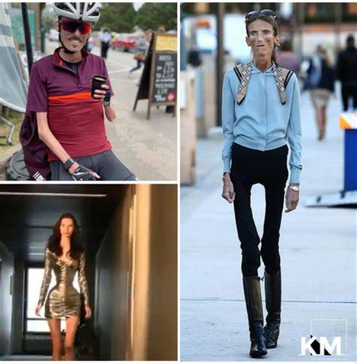 Discovering the Skinniest People in the World: Insights and Stories