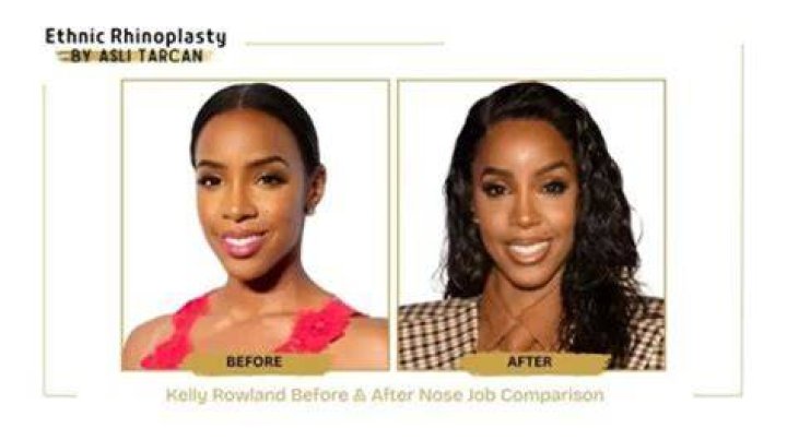 Kelly Rowland: A Journey Through Transformation Before and After