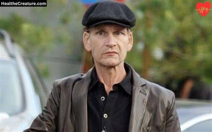 Unraveling the Mystery: What Did Patrick Swayze Die From?